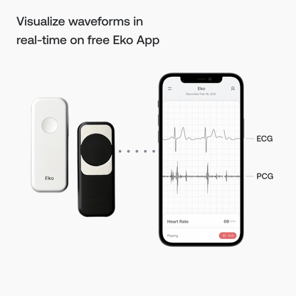 Eko DUO Digital Electronic Stethoscope and ECG with Bluetooth - Eko