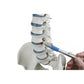 Standard Spine with Prolapse & Pelvis