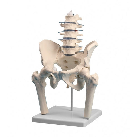 Lumbar Spine with Pelvis & Femoral Stumps - Erler Zimmer