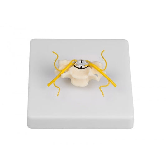 Vertebra with Spinal Cord Section - Erler Zimmer