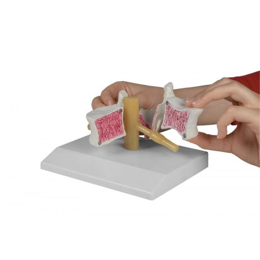 Osteoporosis Vertebra - 2 Times Life-Size - Erler Zimmer