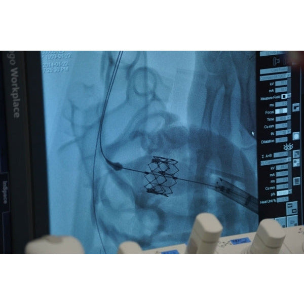 Heart Model - Professional - Clear - Erler Zimmer