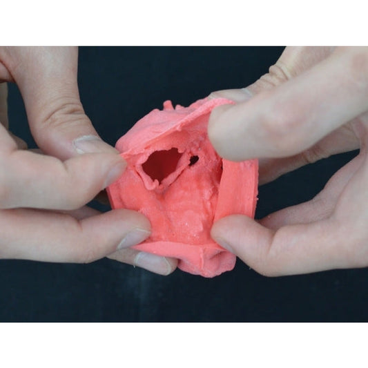 Pediatric Heart with Ventricular Septal Defect (VSD) - Erler Zimmer