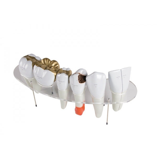 Dental Morphology Series - 7-Part - 10 Times Life-Size - Erler Zimmer