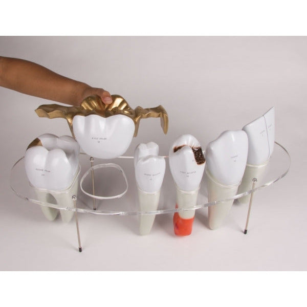 Dental Morphology Series - 7-Part - 10 Times Life-Size - Erler Zimmer