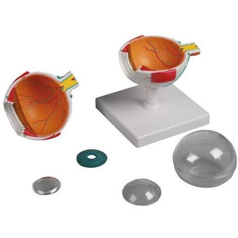 Erler Zimmer Eye Model - 4 Times Life-Size, 6 Parts - 