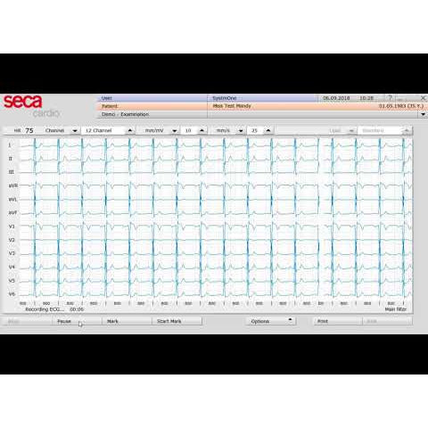 Seca CT321 PC-Based ECG Machine - Bluetooth Version