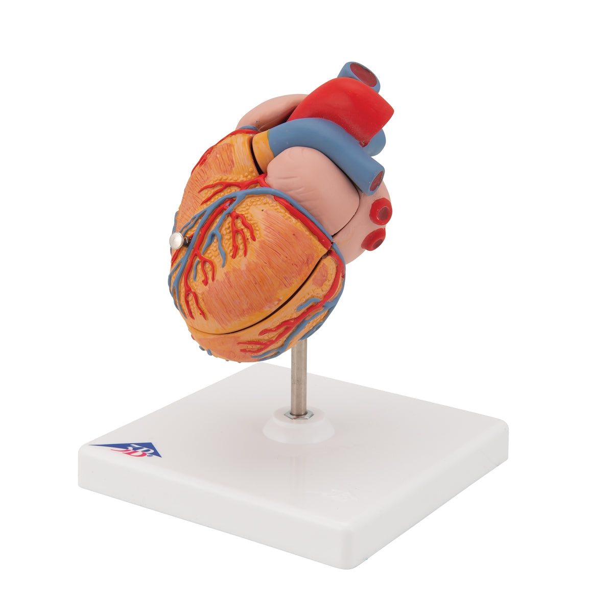 Classic Human Heart Model with Left Ventricular Hypertrophy (LVH), 2 p ...