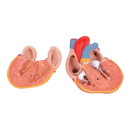 Classic Human Heart Model with Left Ventricular Hypertrophy (LVH), 2 part