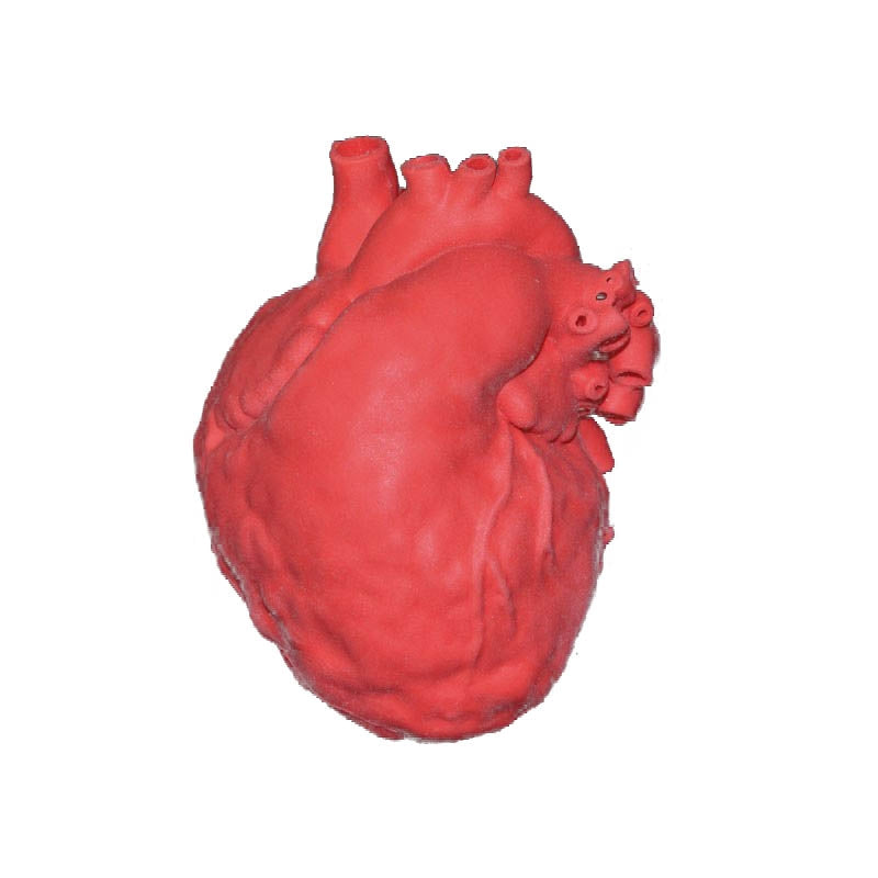 Pediatric Heart with Atrial Septal Defect (ASD) - Erler Zimmer