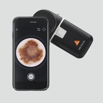 Apple iPhone XR Mounting Case For HEINE DELTA 30/DELTAone - Heine