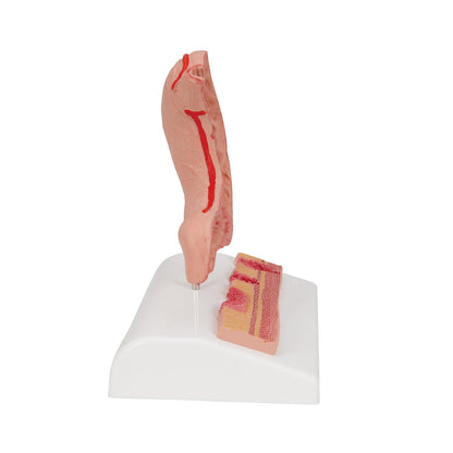 Human Stomach Section Model with Ulcers