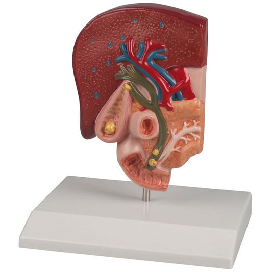Gallstone Model - Half Life-Size