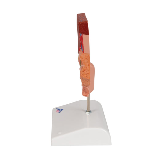 Gallstone Model - 3B Scientific