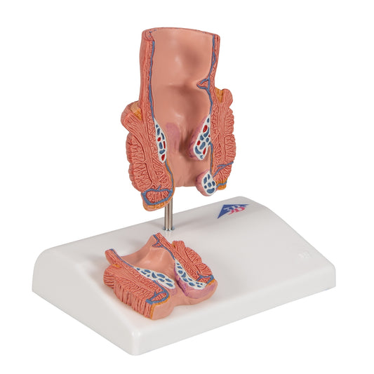 Hemorrhoid Model - 3B Scientific