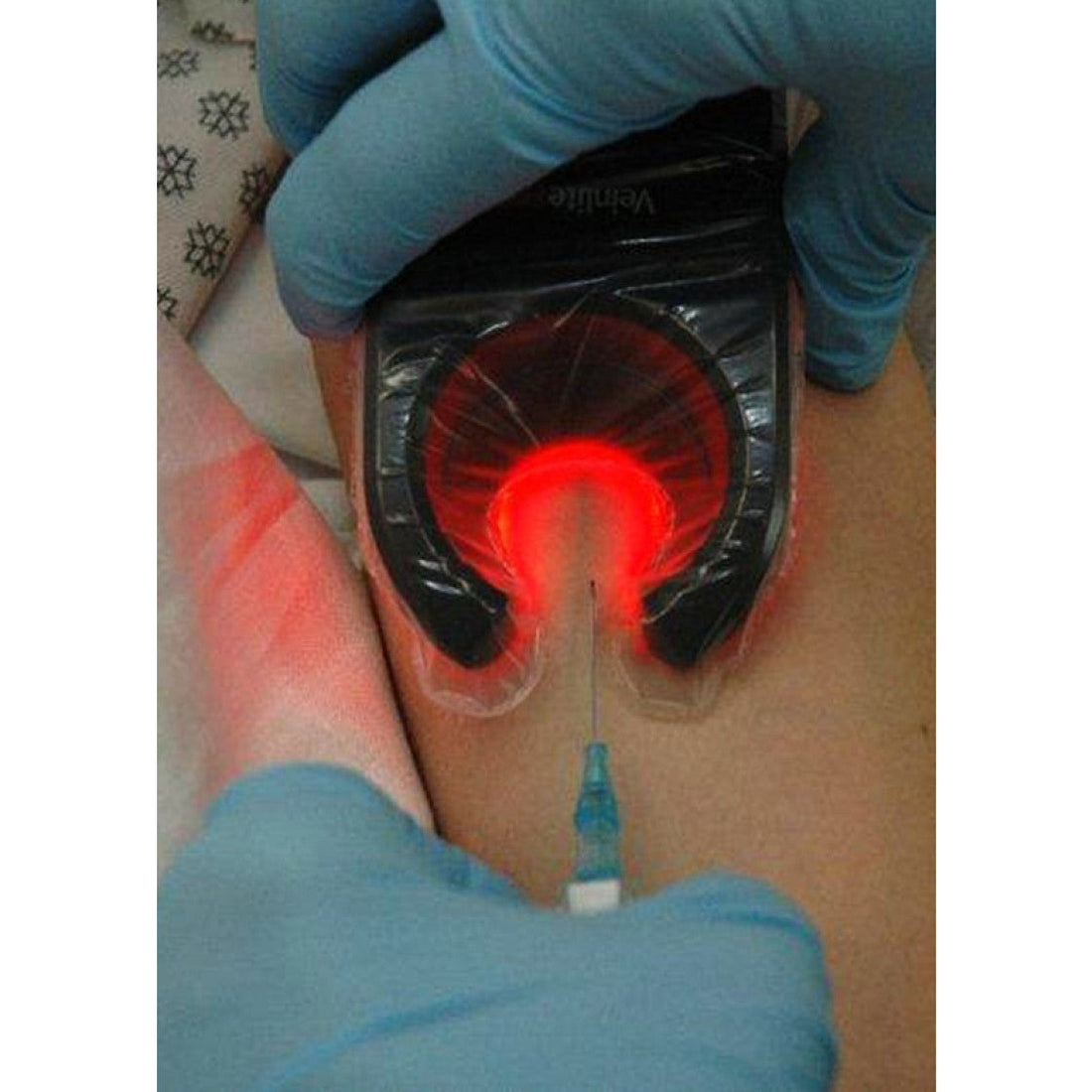 VeinLite LED Skin Transilluminator – Medisave UK