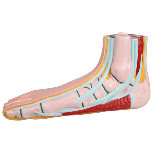 Flat Foot Model - Life-Size