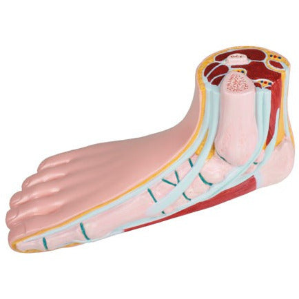 Flat Foot Model - Life-Size