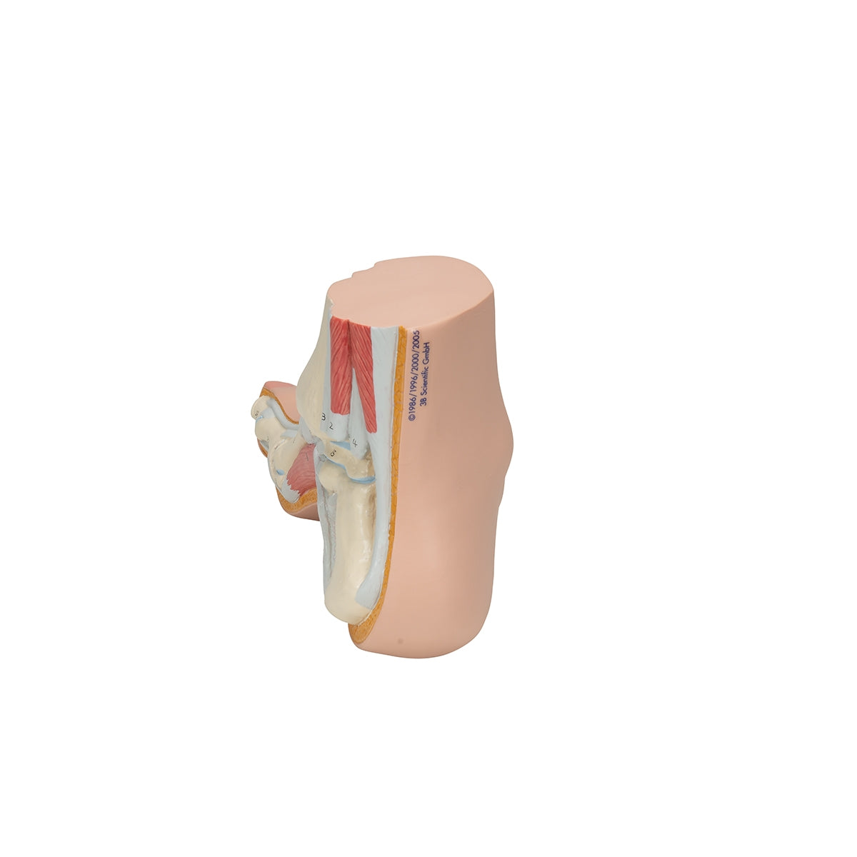 Hollow Foot (Pes Cavus) Model - 3B Scientific