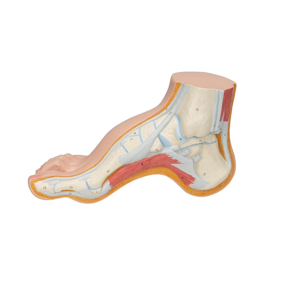 Hollow Foot (Pes Cavus) Model - 3B Scientific