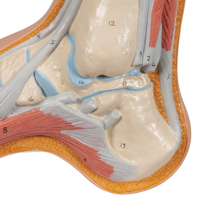 Hollow Foot (Pes Cavus) Model - 3B Scientific