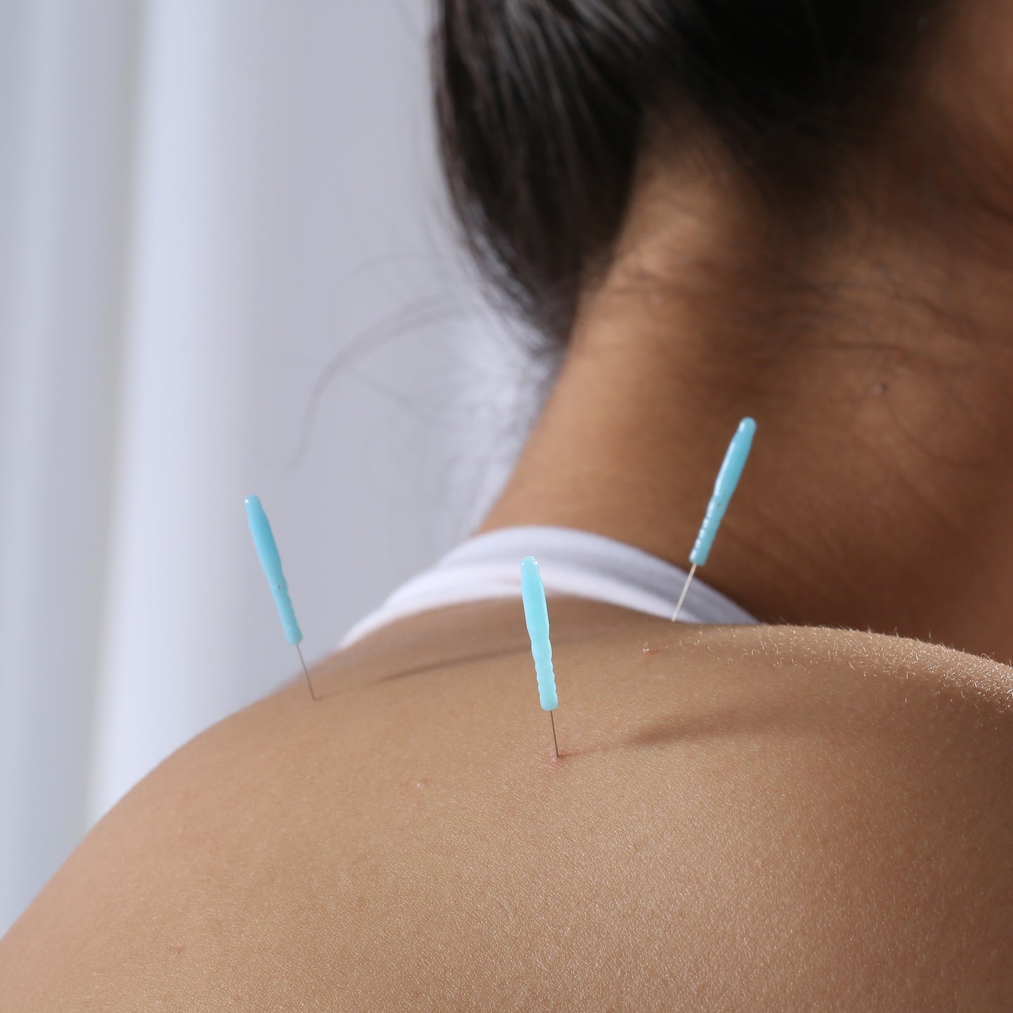 P- plastic handle Type Acupuncture Needle (guide tube) 0.12 x 15mm - Phoenix Medical