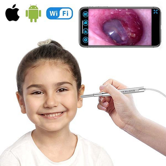 Digital Otoscope - Camera Diameter: 4.3mm + WiFi - iPhone / iPad / Android - Discontinued