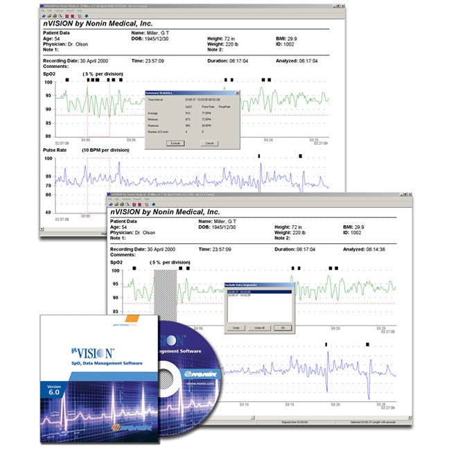 Nonin nVision PC Software for 3150 WristOx2® Pulse Oximeter - Nonin