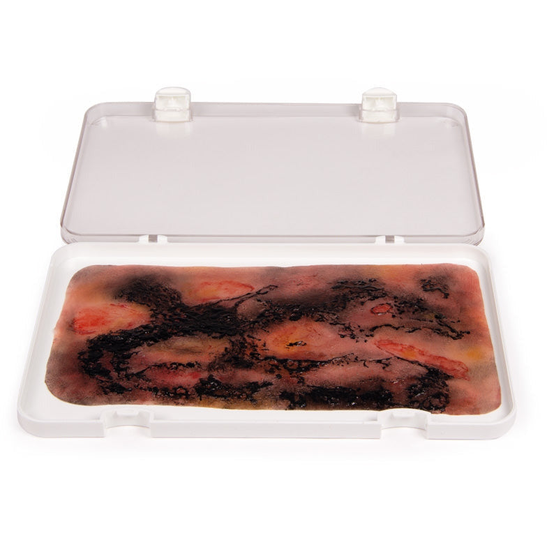 Wound Moulage 3rd Degree Burn - Large - Erler Zimmer