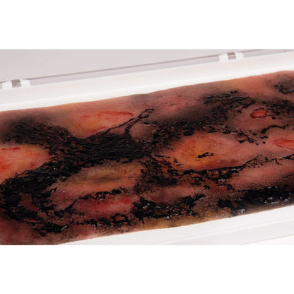 Wound Moulage 3rd Degree Burn - Large - Erler Zimmer