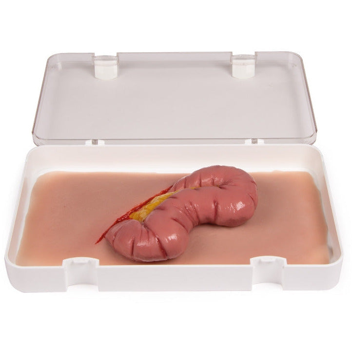Wound Moulage Protrusion Of Large Intestines - Erler Zimmer