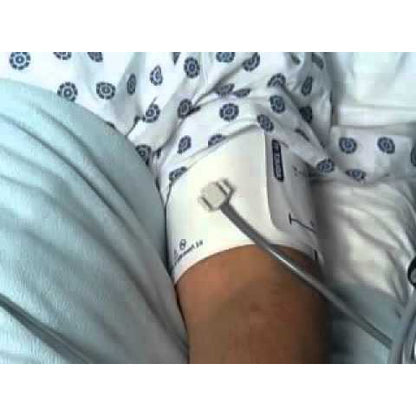 Welch Allyn Flexiport Adult Cuff size 11L One Tube Locking (25-34cm) - 