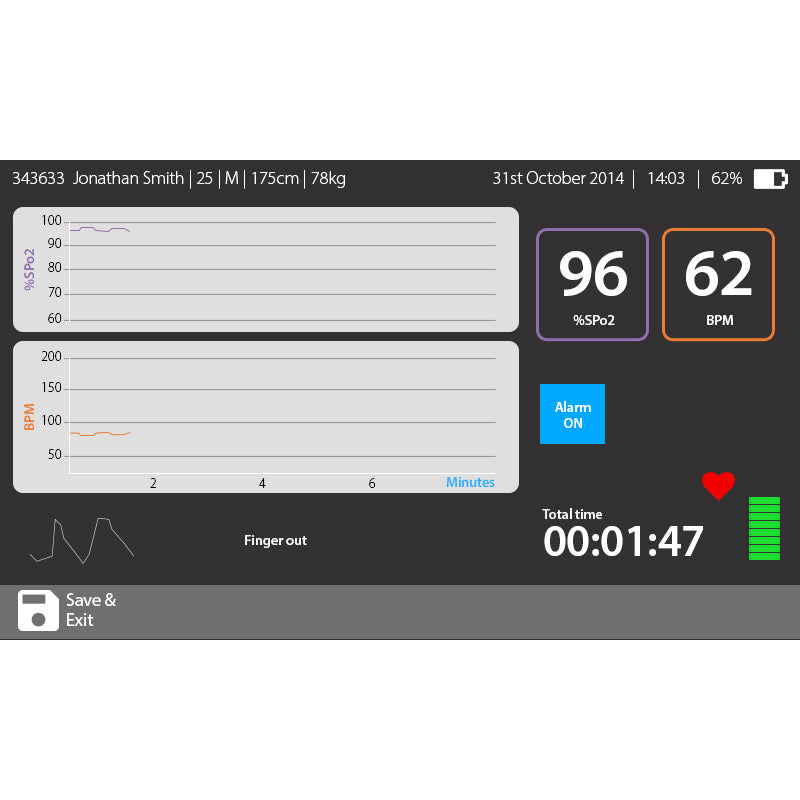 MIR Intermedical Spirolab Spirometer with Reusable Turbine
