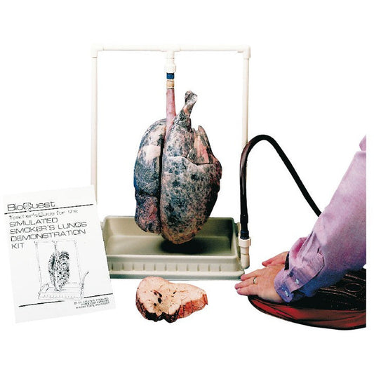 Smokers Lung Model