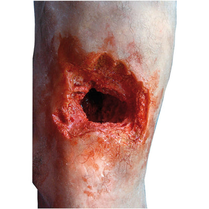 Emergency Leg - Erler Zimmer