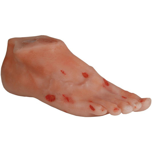 Diabetic Foot Model