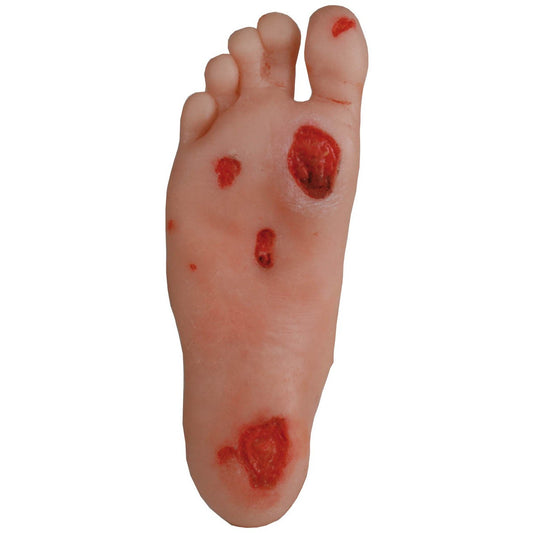 Diabetic Foot Model