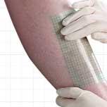 OpSite Flexigrid 15cm x 20cm per 10