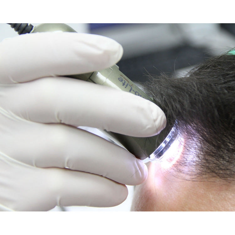 TrichoScope Basic - Dino-Lite