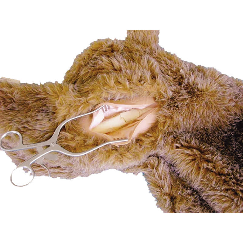 Femoral Leg Bone Fracture - Erler Zimmer