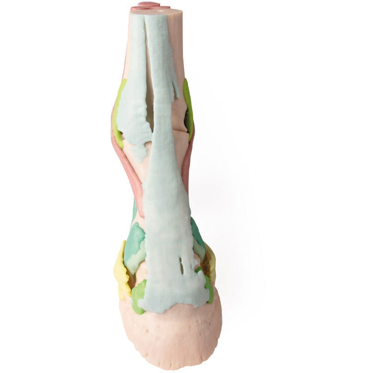 Foot of a Horse - Model 1 - Erler Zimmer