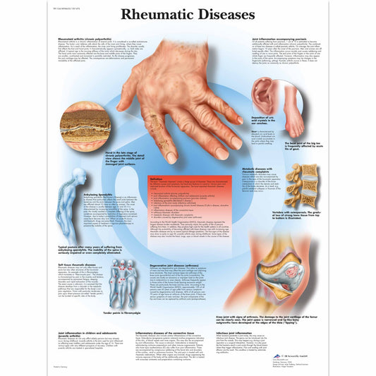 Rheumatic Diseases Chart - 3B Scientific